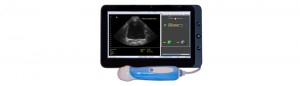 Portable Ultrasound Machines Canada -View_bladder10